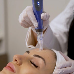 Skin Needling - Buy 3 get 4!